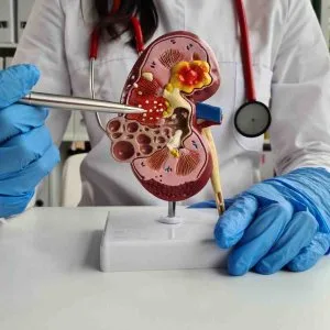 Medical specialist for kidney disease expert diagnosis care