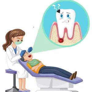 Emergency root canal for fast tooth pain relief