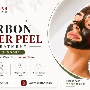 Best carbon laser peel treatment in indore aestheva