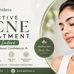 Active acne treatment in indore aestheva