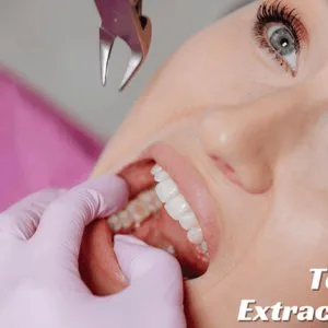 Tooth removal cost is not always the same