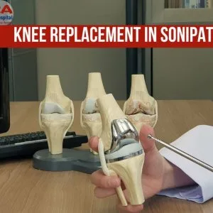 Affordable knee replacement in sonipat with modern healthcare