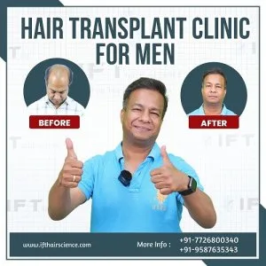 Best men hair transplant doctor in india