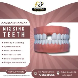 10 reasons you should never ignore a missing tooth