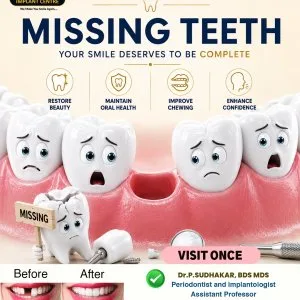 Permanent solutions for missing teeth advanced dental implants