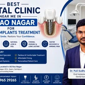 Best dental clinic for dental implants near as rao nagar