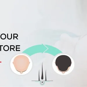 Get natural looking beard transplant in surat