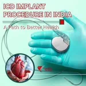Cost of icd implantation india