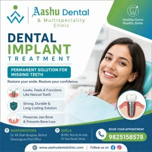 Dental implants treatment ahmedabad dr manish shah