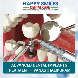 Advanced dental implants treatment vanasthalipuram clinic