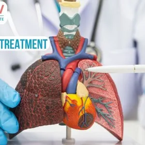 Professional lung cancer treatment in delhi ncr with personalize