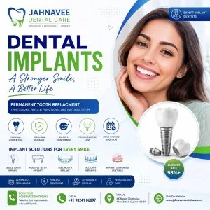 Dental implants in ahmedabad jahnavee dental care
