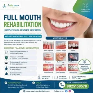 Full mouth rehabilitation in navrangpura