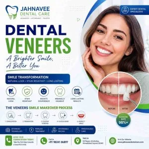 Cosmetic dental veneers treatment jahnavee dental care