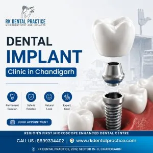 Dental implant clinic in chandigarh for advanced tooth replacem