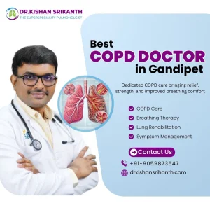 Best copd doctor in gandipet dr kishan srikanth juvva