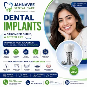 Best dental implants in ahmadabad jahnavee dental care