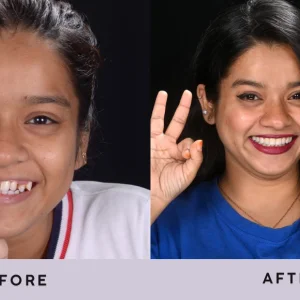 A cosmetic dentist who gives attention to your facial structure