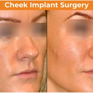Best antiaging face wrinkle treatment in mumbai dr rinky k