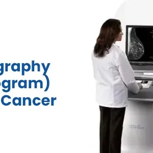 Digital mammography test cost in hyderabad