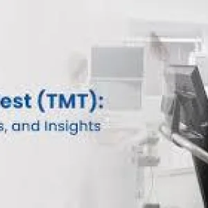 Treadmill test in hyderabad cardiac stress test services