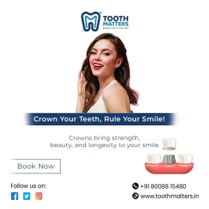 Longlasting zirconia crown care following root canal treatment
