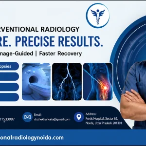 Nonsurgical treatment in noida