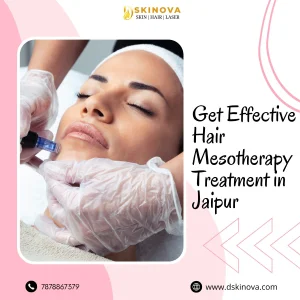 Get effective hair mesotherapy treatment in jaipur