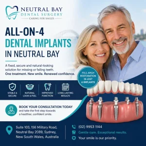 Allon4 dental implants in neutral bay for a secure new smile
