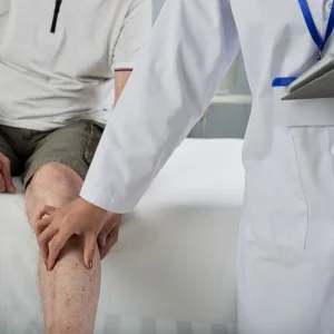 Varicose veins specialist doctor in delhi