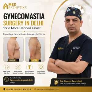 Male breast reduction surgery in delhi expert treatment option
