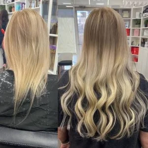 Book online private hair loss consultation in dallas