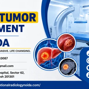 Liver tumor treatment in noida