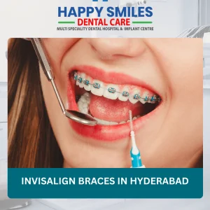 Invisalign braces in vanasthalipuram for a confident smile