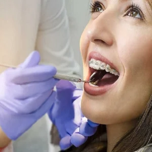 Need a walk in dentist in fort worth call prestige dental