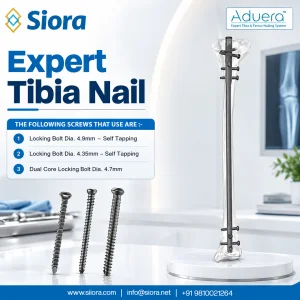 Aduera expert tibia nail titanium