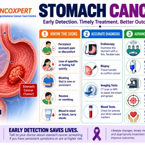 Stomach cancer specialist in mumbai dr sanket shah
